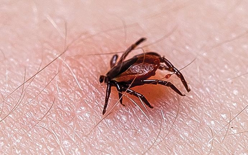 a tick biting a person in Aiken South Carolina